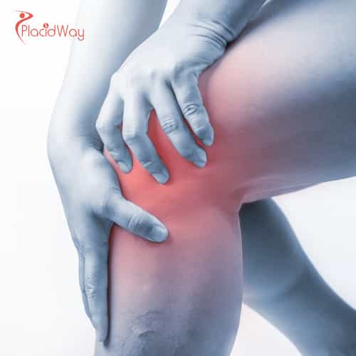 How Can Canadians Save on Stem Cell Therapy for Knee Injuries by Traveling to Mexico?